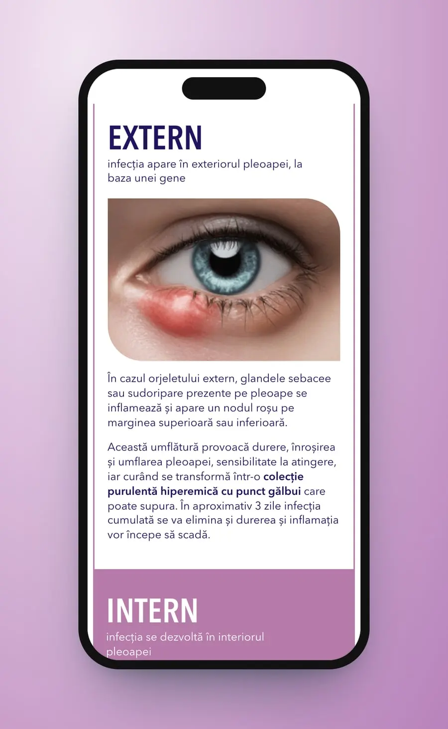 Extern on a phone: the line, a photo of an external stye and the paragraph, Intern starting on lilac below