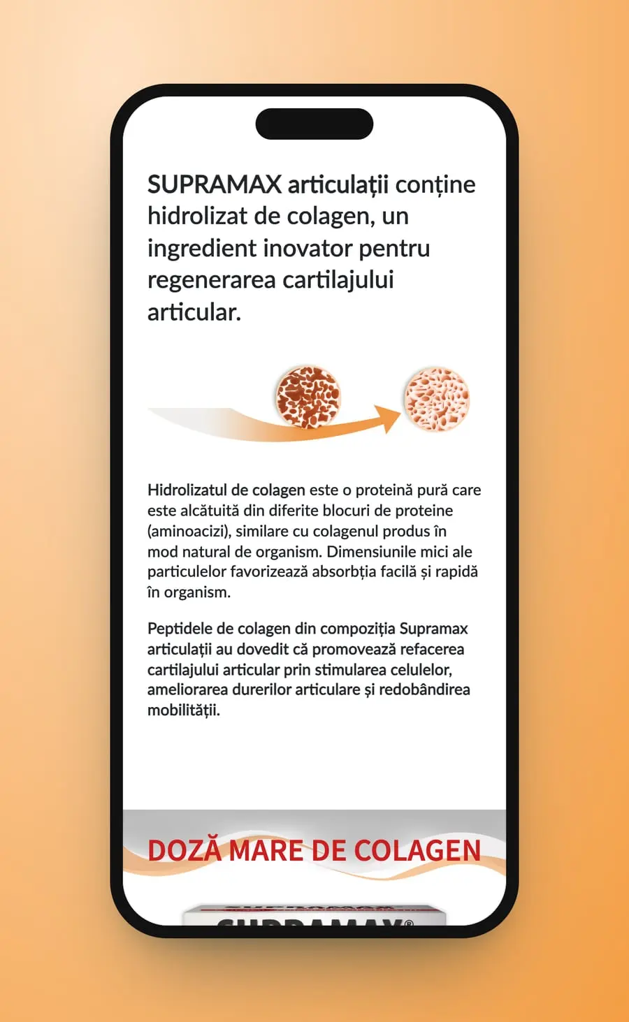 The collagen line on a phone, the arrow between the circles of bone tissue and the paragraphs below