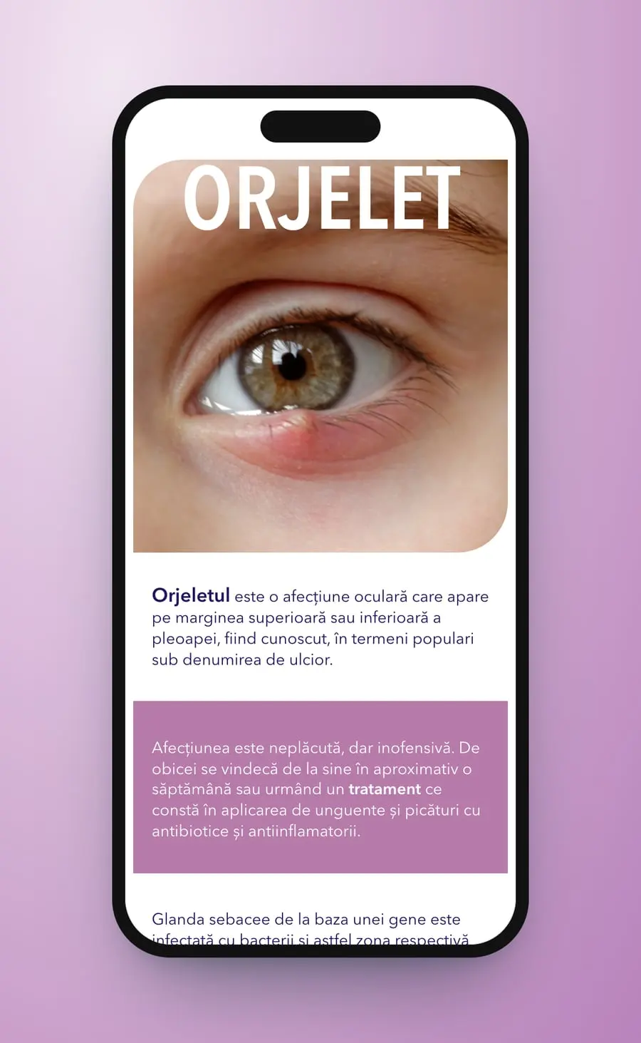 ORJELET on a phone: the photo of the stye and the first text tiles below it
